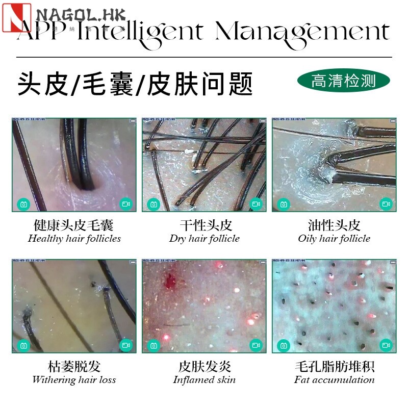 新款头皮检测仪皮肤检测仪毛囊四光谱面部分析双探头一体机美容院