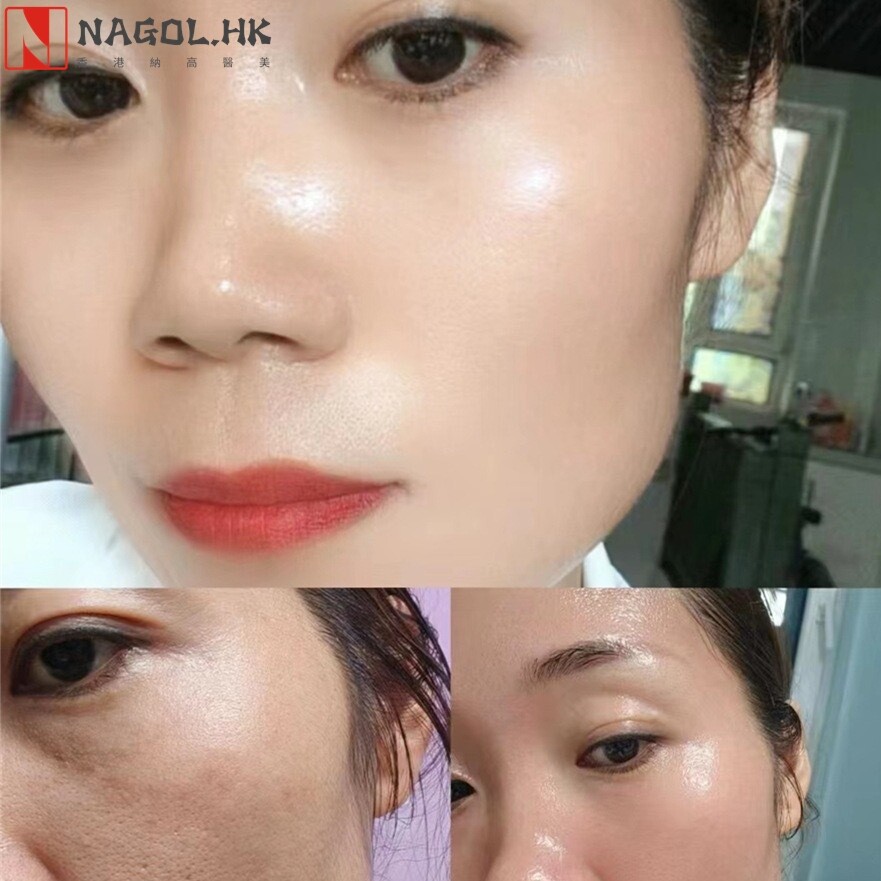 美白祛斑套装淡斑控色打造灯泡肌美白精华液极光美肌套美容院