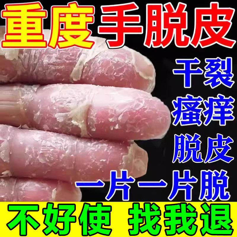 【9.8w手脱皮人选择】霜