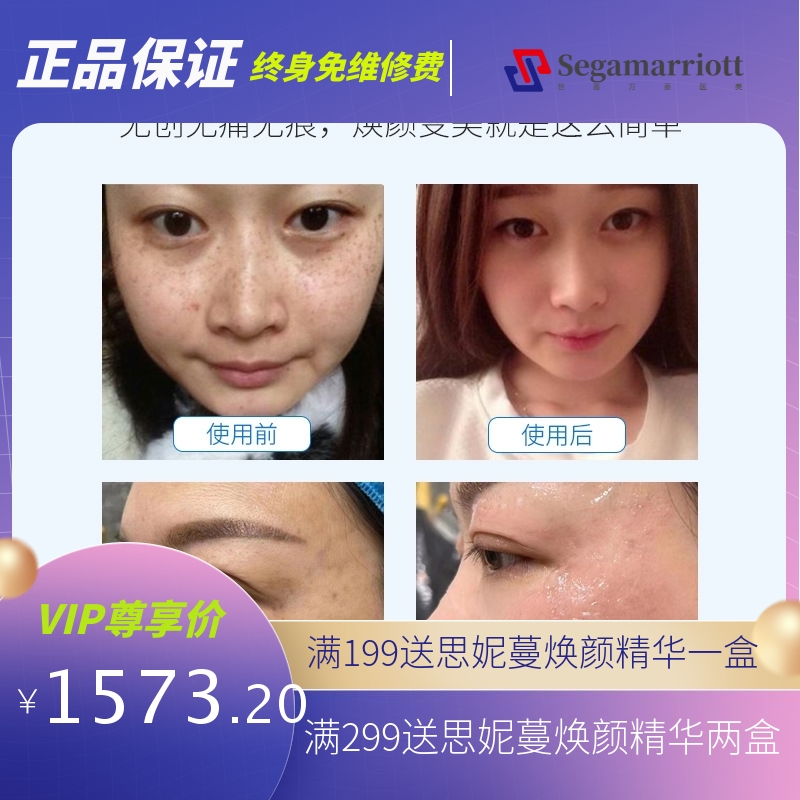 5G黑科技无创祛斑仪磁波扫斑仪脸部无痕护理美容院取斑点痣秒斑王