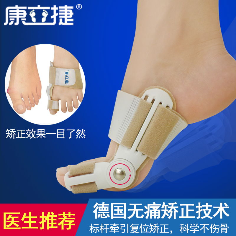 大脚骨母趾头分离可以外翻矫正器