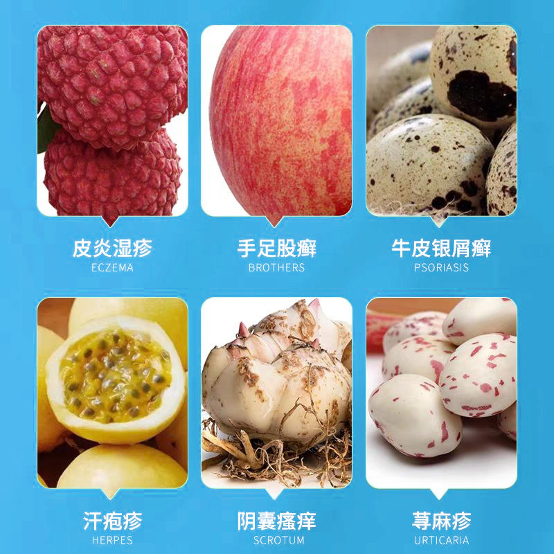 顽固阴囊湿疹外用止痒皮肤汗疱疹水泡非皮炎药膏喷雾剂去湿痒根lc