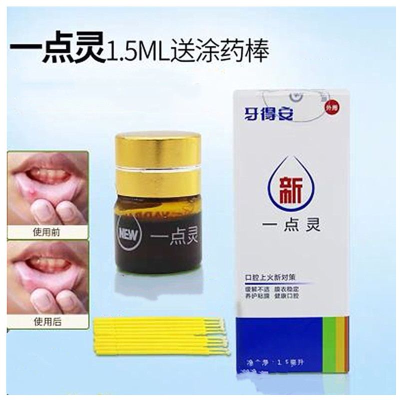 牙科口腔溃疡口疮上火烂嘴