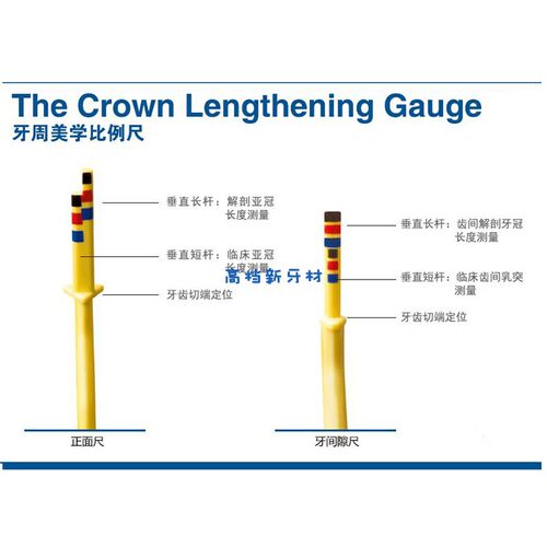 牙科材料  美国豪孚迪牙周美学比例尺CLGS