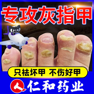 【仁和】环吡酮胺乳膏10g0.1g*1支/盒