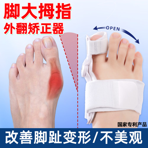 脚大拇脚指头外翻足纠正大脚骨突出分离重叠男女士拇指外翻矫正器