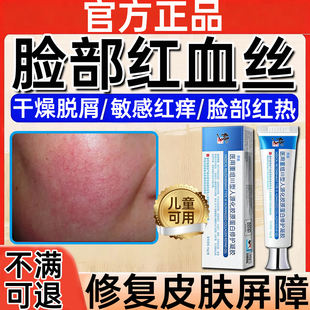 敏感肌修复脸部泛红去红血丝面膜脸部干燥脱屑瘙痒红热修护凝胶WY