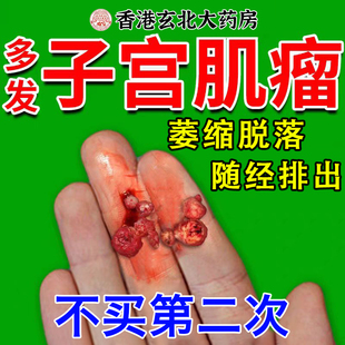 子宫肌瘤中药贴泡脚药包消除吃什么药艾灸多发性卵巢囊肿月经多UU