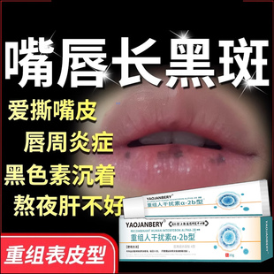 嘴唇黑斑搭配去除膏药黑色素沉淀黑点黑痣唇炎部护理淡化医用型TT