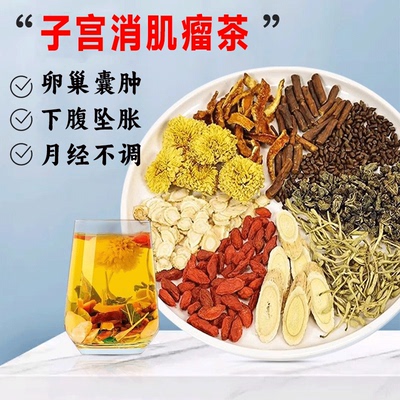 子宫肌瘤茶中药贴自己治疗消除宫瘤清调理卵巢囊肿的巧克力腺症GX