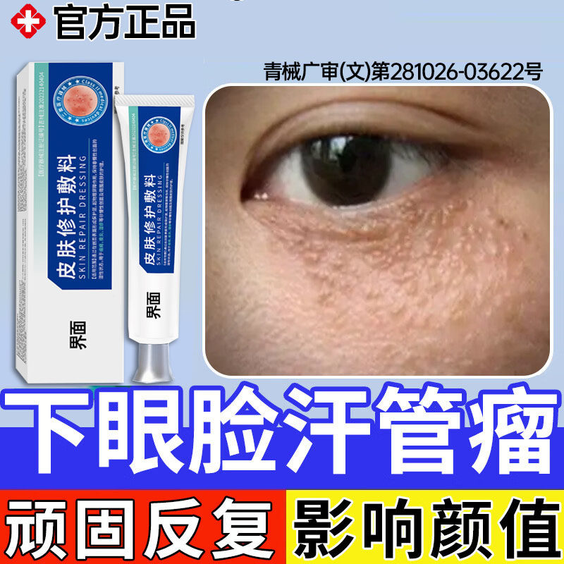 汗管瘤眼部去除神器眼周消除小疙瘩皮下脂肪粒扁平疣医用级药膏XY
