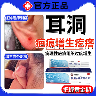 耳洞增生去除疤痕疙瘩耳朵凸起硬肉防增生脂肪瘤肿硬块耳朵垂MR