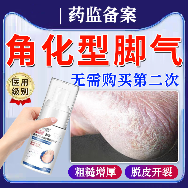 脚后跟干裂真菌感染鳞屑角化型脚气开起硬皮足跟足癣脚癣一次净TT