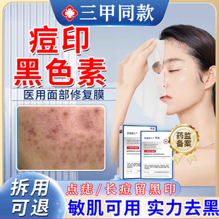 脸上祛黑痘印黑色素沉淀去除祛斑后反黑修复淡化痘印疤痕面膜TT