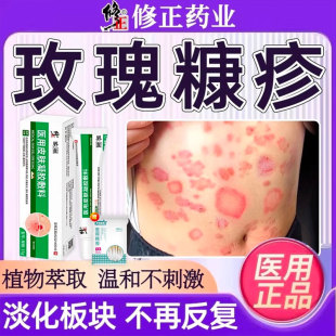 玫瑰糠疹专用药治疗皮肤瘙痒长癣红斑汗斑花斑止痒特效药根除gx