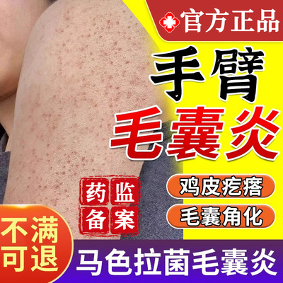 【问德堂】改善鸡皮肤
