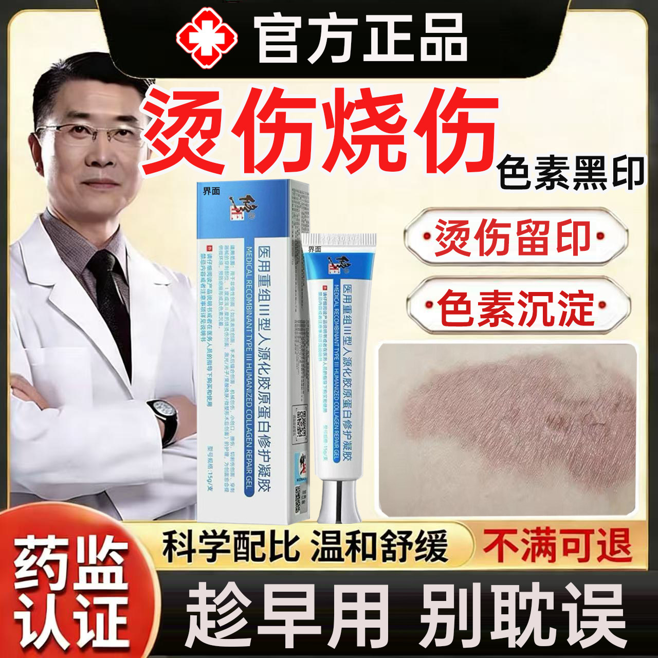 烫伤烧伤疤痕修复除疤膏去黑印色素沉淀油烫伤淡化疤印去伤疤印MR
