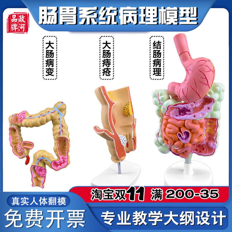 人体肠胃模型结肠大肠直肠模型医院校用教学演示优质
