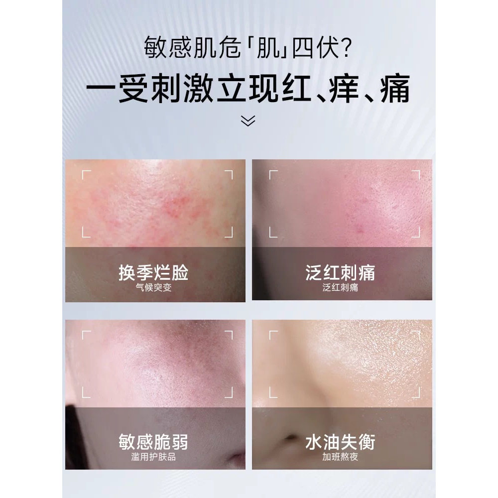 皮宝舒缓修护霜80g油敏肌专属屏障修护清爽不油腻DB