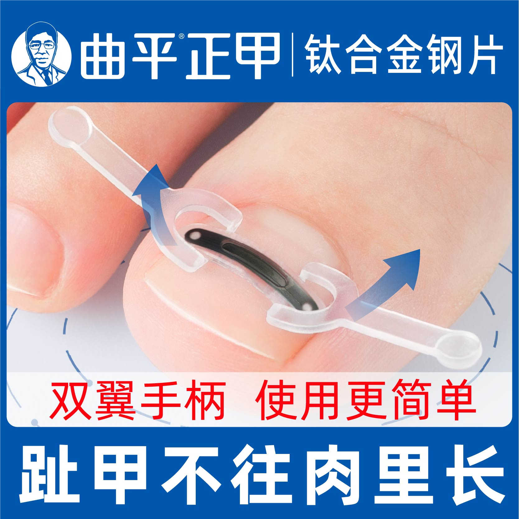 曲平医生甲沟嵌甲矫正器钛合金