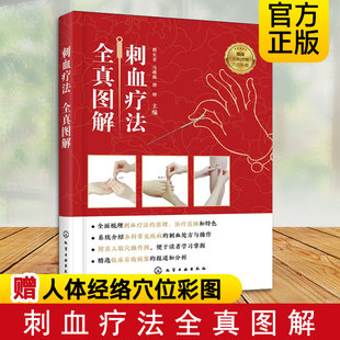 中醫(yī)針灸刺絡放血療法 刺血治百病 刺血療法全真圖解 放血療法書籍 中醫(yī)刺絡放血療法圖書籍 刺血療法書籍中國刺血療法大全 正版