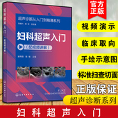 超声断面图体位图手绘示意图 超声诊断从入门到精通系列 超声入门影像读片指南 配视频讲解 医学影像参考书 妇科超声入门
