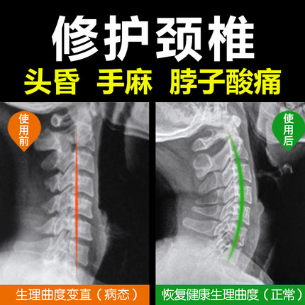 颈椎枕头睡觉专用修护劲椎护颈病人荞麦助睡眠家用艾草组合圆枕硬