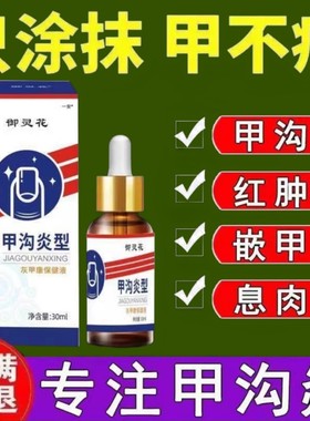 御灵花甲沟Y型灰甲康保健液灰指甲抑菌液增厚亮甲脱甲软甲膏01164