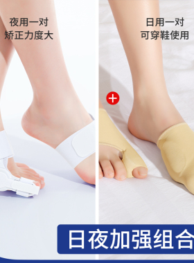 日本脚趾矫正器拇指外翻纠正脚趾神器男女士大母足脚骨突出可穿鞋