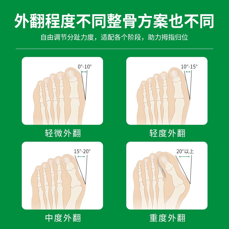 德国大脚趾矫正器女大拇指外翻儿童大脚骨纠正神器男母指头分趾器