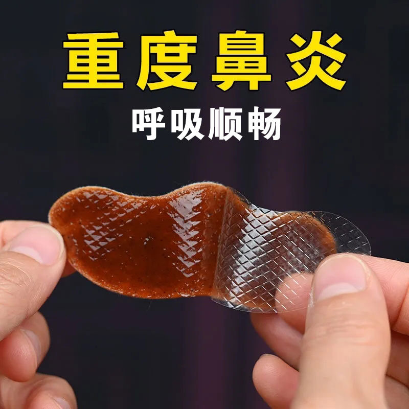 鼻炎贴鼻窦炎过敏性鼻炎专用鼻甲肥大膏药贴根喷剂中治疗热敷儿童