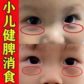 积食消食化食积贴小儿健脾贴膏宝宝健脾胃消积食去内热儿童肚脐贴