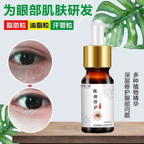 不消包退去脂肪粒去除神器眼部专用膏工具祛除油脂粒汗管粒的眼霜