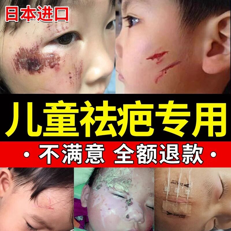 去疤痕除疤非祛疤膏儿童专用小孩修复除疤膏日本官方旗舰店