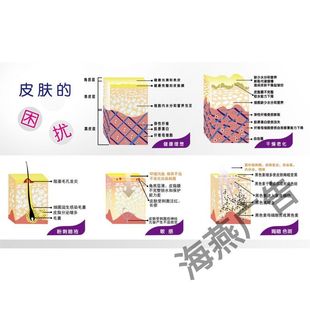 美容院皮肤解析图海报宣传画皮肤结构图贴画 美容院墙贴纸自粘画