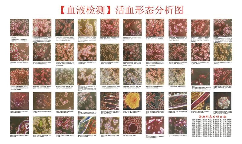 人本血液检测血样活血形态分析图墙上挂图海报印制展板墙贴纸
