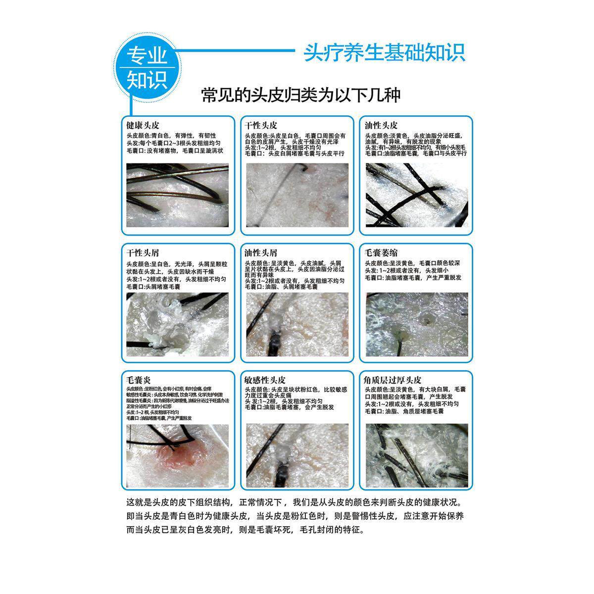 头皮检测海报头皮护理海报对照图海报中医调理养生馆装饰墙贴广告
