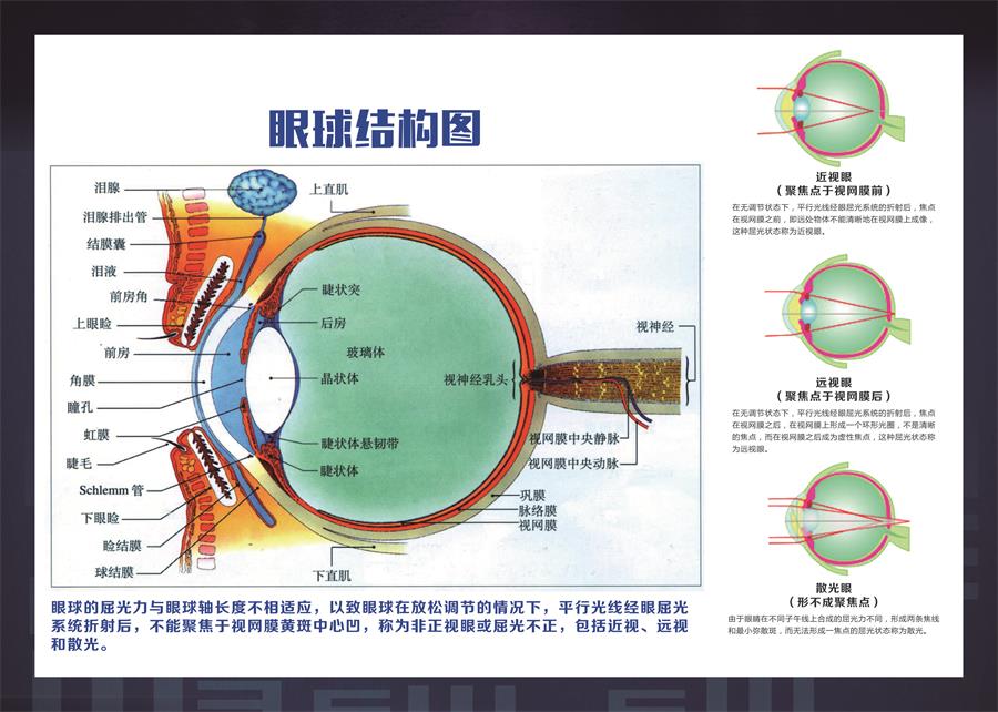 眼部结构图眼科眼镜店常识科普挂图展板喷绘海报印制挂图墙贴纸