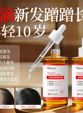 腺苷育防脱发液生增发密发神头发际线快速增长器侧柏叶精华营养剂