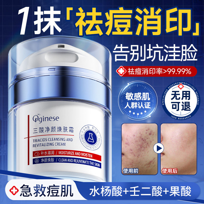 三重酸祛痘淡化痘印祛痘膏壬二酸去痘坑男女生痘消闭口炎粉刺面霜