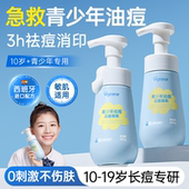 青少年洗面奶控油祛痘淡化痘印氨基酸青春期少女男洁面乳学生专用
