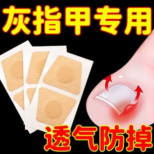 趾甲修护贴软甲嵌甲灰指甲增厚亮甲沟修护贴脚指甲遮丑贴 2025新款