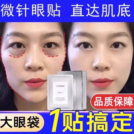 玻尿酸可溶性微针眼贴眼膜淡化黑眼圈细纹抗衰紧致官方旗舰店正品