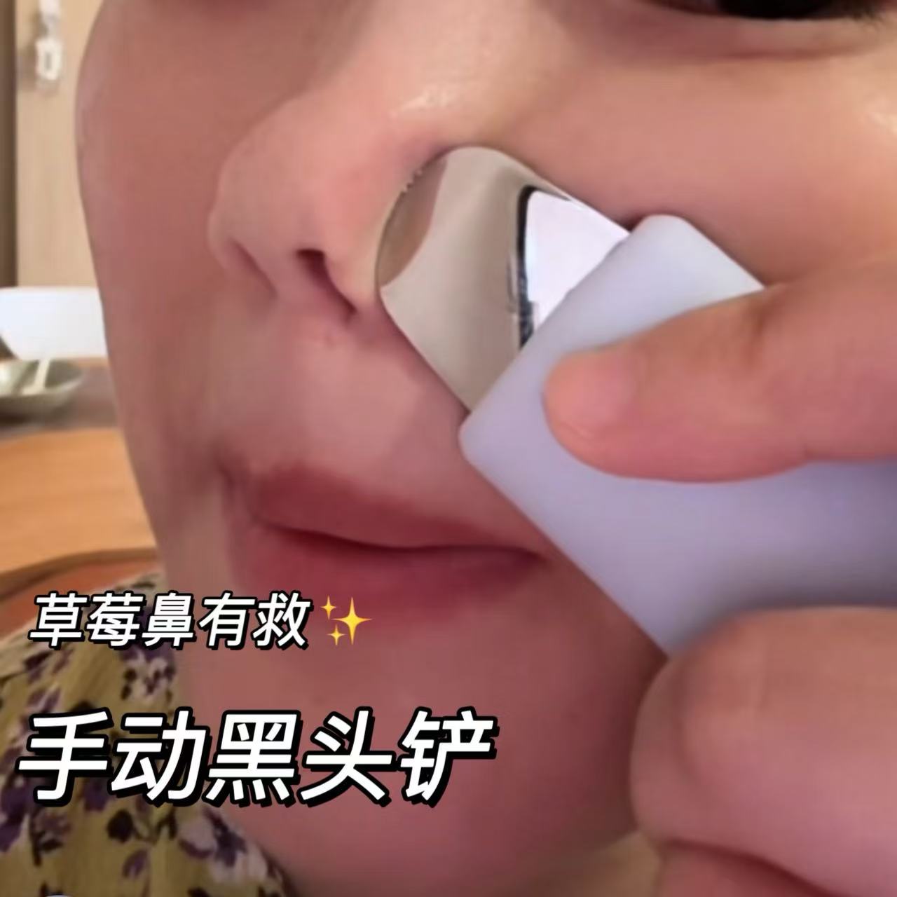 手动清洁超薄去黑头铲