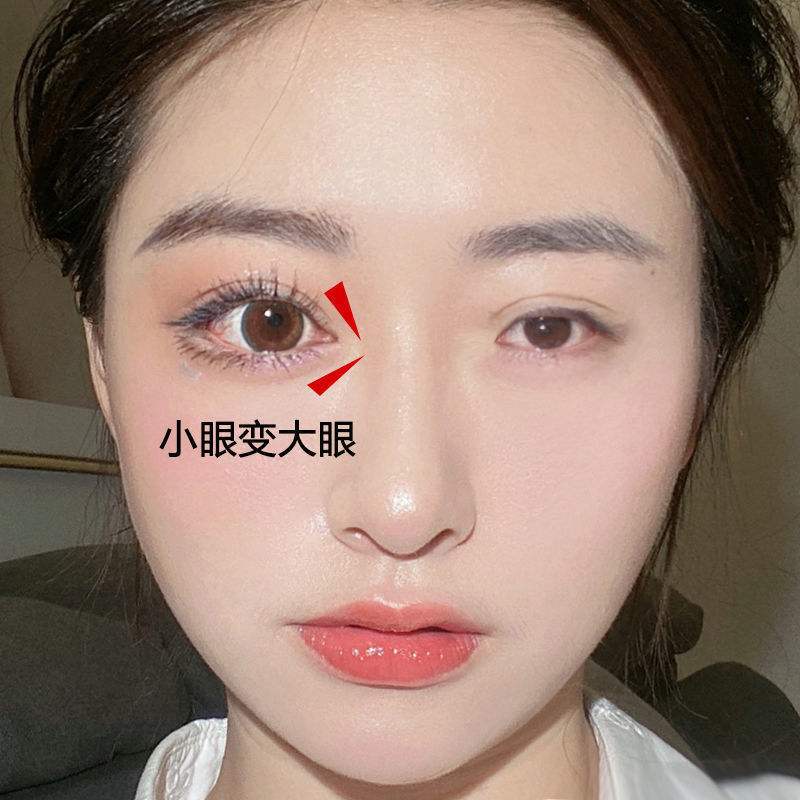 新款佰草世家扩眼神器单眼皮变永久双眼皮肿眼泡变大开眼角大眼睛