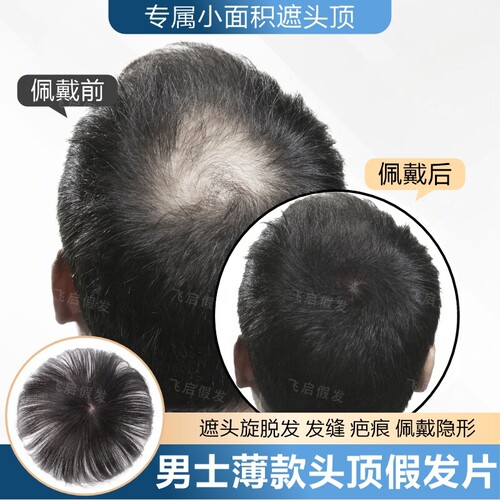 假发男士全真发遮盖头旋发缝增发量补发片隐形无痕后脑勺头顶蓬松