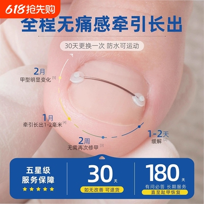 指甲矫正套装|超1000次加购