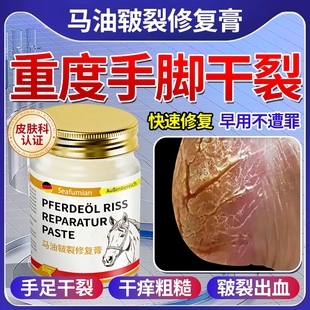 脚后跟干裂修复霜防脚裂手指裂口龟裂干燥起皮足底皴裂马油膏正品
