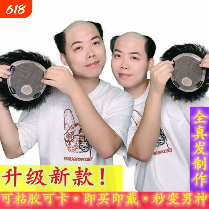 假发男真发补发片新款头顶地中海短发粘贴爸爸假发片中老年可水洗