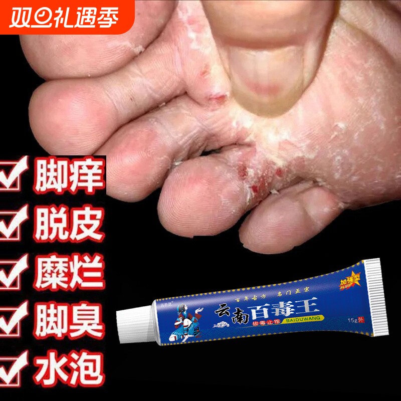 苗药百毒王药膏旗舰店抑菌奇草去气脚水泡皮肤止痒膏脚丫子痒烂脚